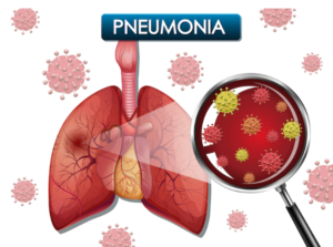 pneumonia menyerang sistem pernapasan